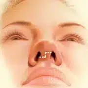 nose3.jpg
